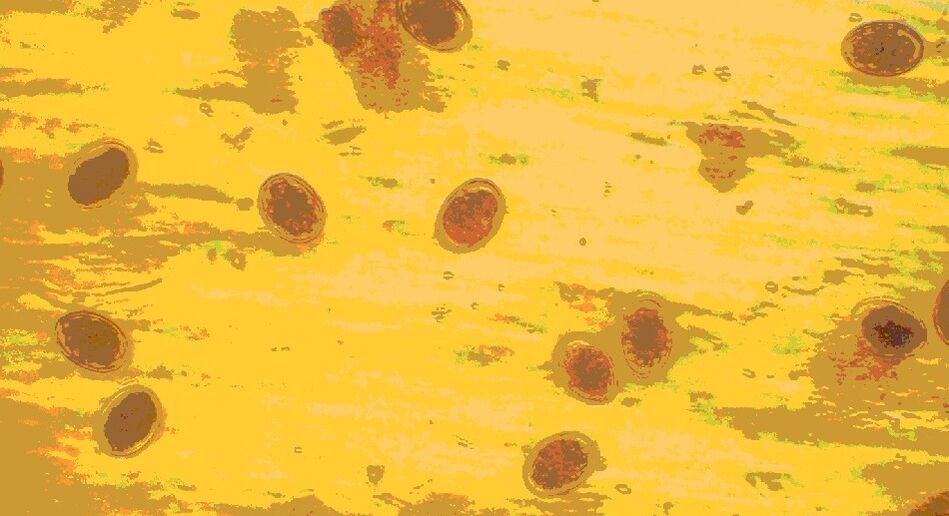 αυγά σκουληκιών κάτω από ένα μικροσκόπιο