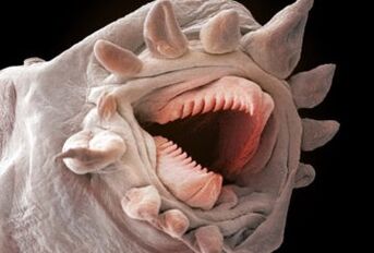 τι σκουλήκια μπορούν να ζήσουν στο ανθρώπινο σώμα